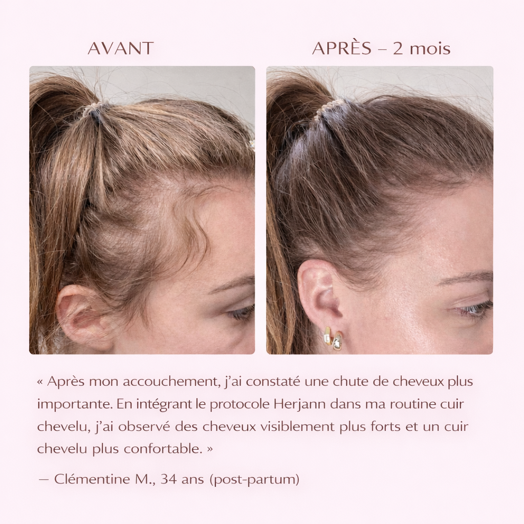 Spray Herjann Fortifiant et Anti-chute