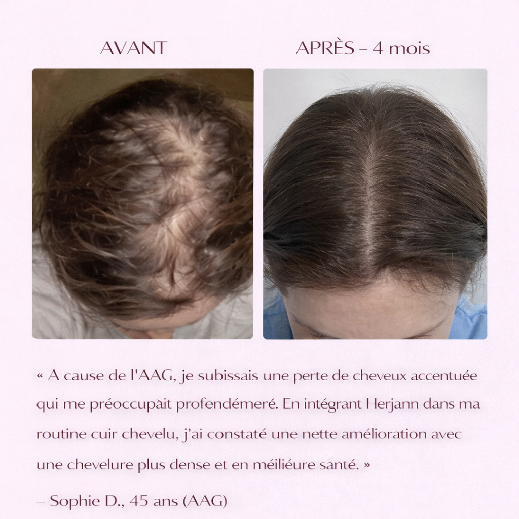 Spray Herjann Fortifiant et Anti-chute